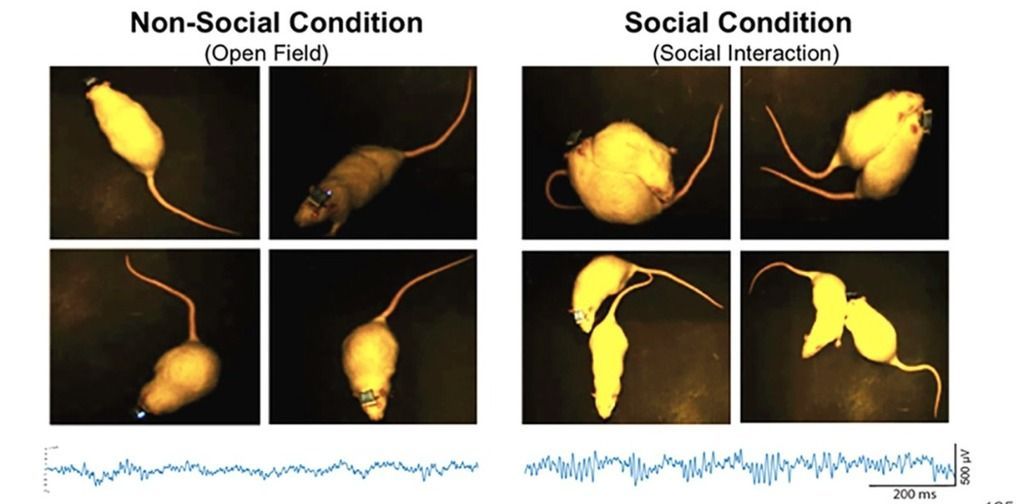 Gamma EEG