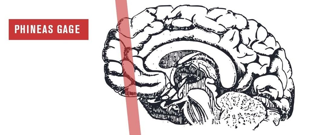 phineas gage