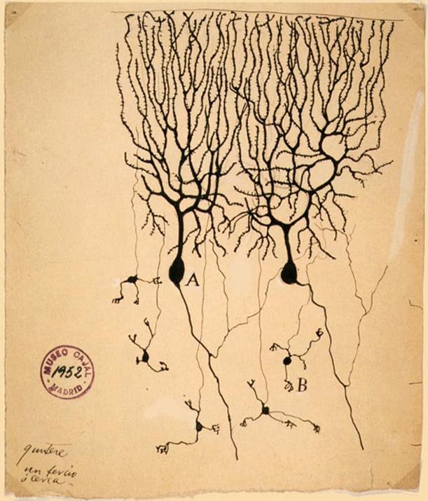 Purkinje cell