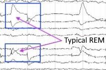 REM sleep EEG