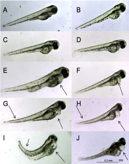 zebrafish-cannabinol-malformations