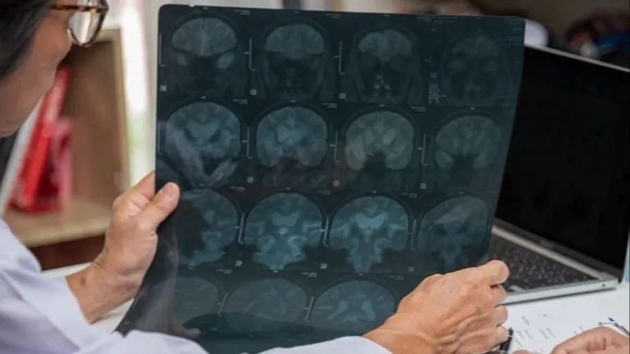 Understanding epilepsy through a new mouse model