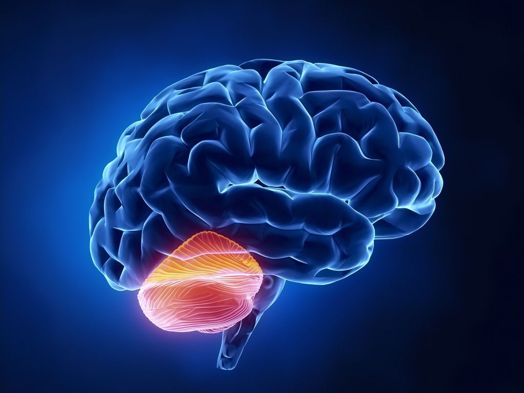 Ataxia