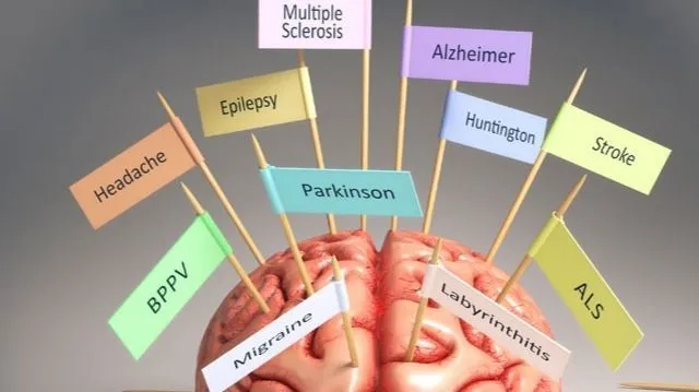 brain-with-flags